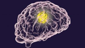 נוירופדגוגיה יישומית