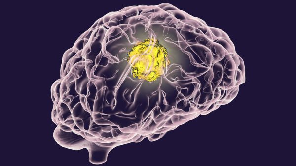 נוירופדגוגיה יישומית